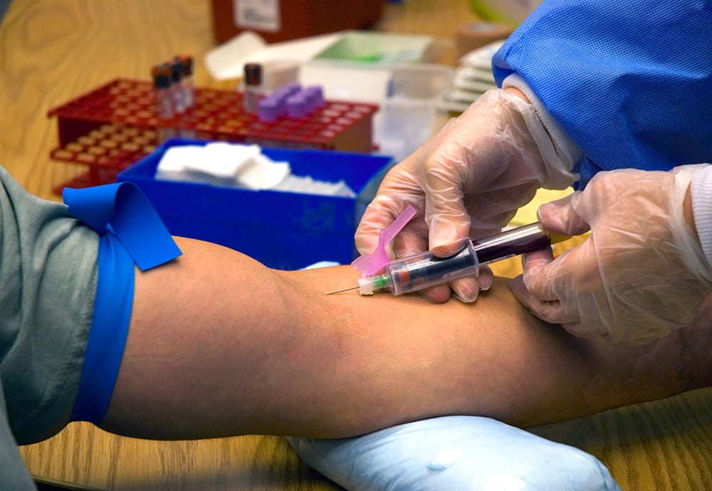 Imagen de una jeringuilla sobre un brazo durante una prueba de extracción de sangre.  