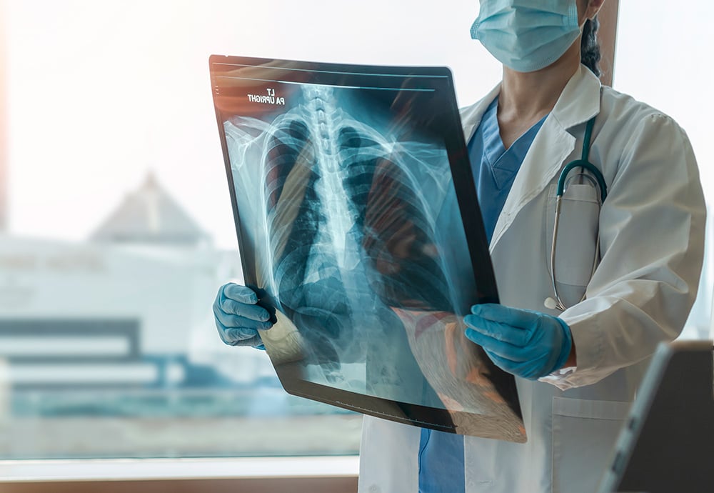 Una médico sostiene una radiografía de unos pulmones en su consulta. 